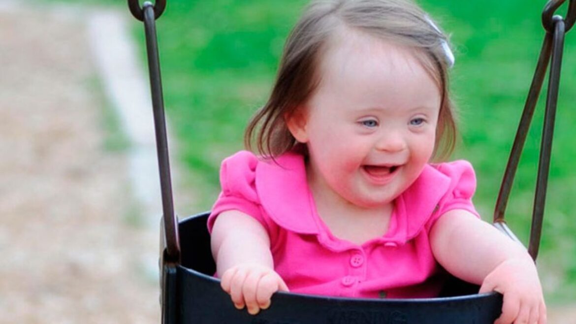 Fisioterapia en pacientes con síndrome de down: Abordajes desde la fisioterapia, tratamiento de fisioterapia