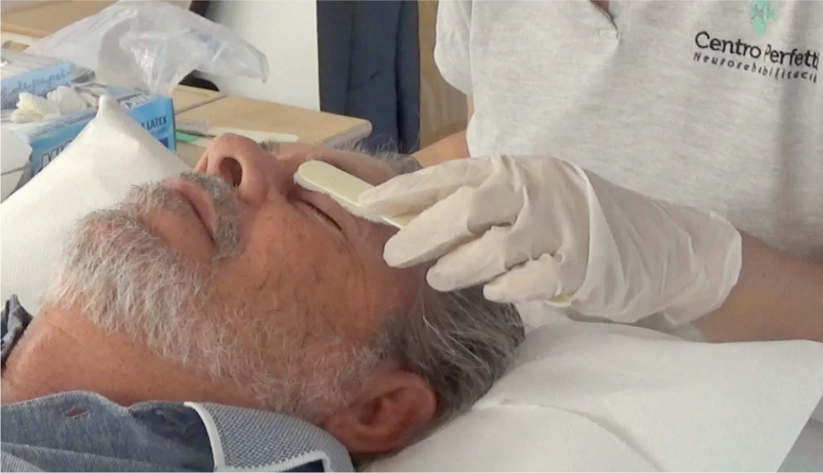 Parálisis de Bell: ¿Qué es? , signos, síntomas, etiología, epidemiología, tratamiento fisioterapéutico